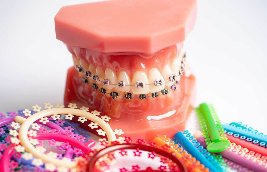 chewing tobacco with braces Orthodontics